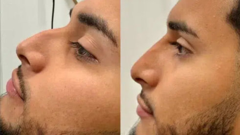 Before and after images of a man’s face