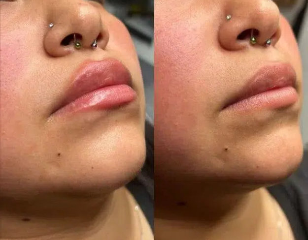A woman with a nose piercing shown before and after