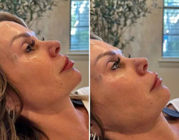 Side-by-side comparison of a woman’s face